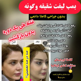 کرم و چسب لیفت دائم اورجینال فرانسوی
